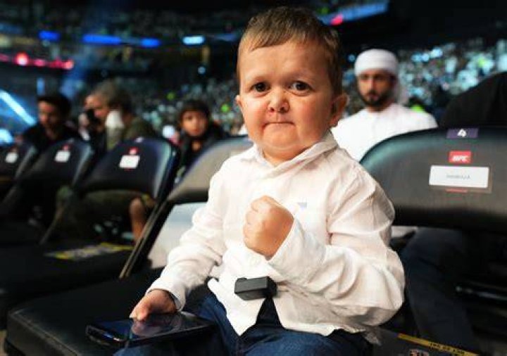 Hasbulla Disability: What Condition Does Mini Khabib Have?