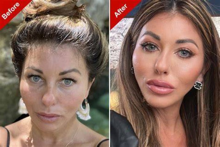 NJ: Who Is Best Plastic Surgery Dr Joseph Racanelli DO? His Age Wiki Net Worth