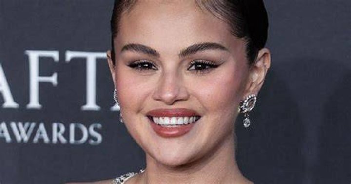 What’s up With Selena Gomez’s Chin Scar? Accident or Chin Implants?
